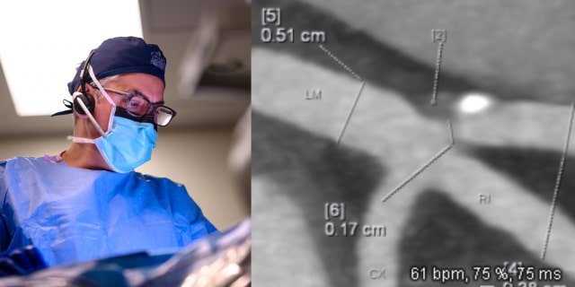 Cardiologist’s wake-up call: How a $499 Heart Scan raised red flags for Dr. David Sandler